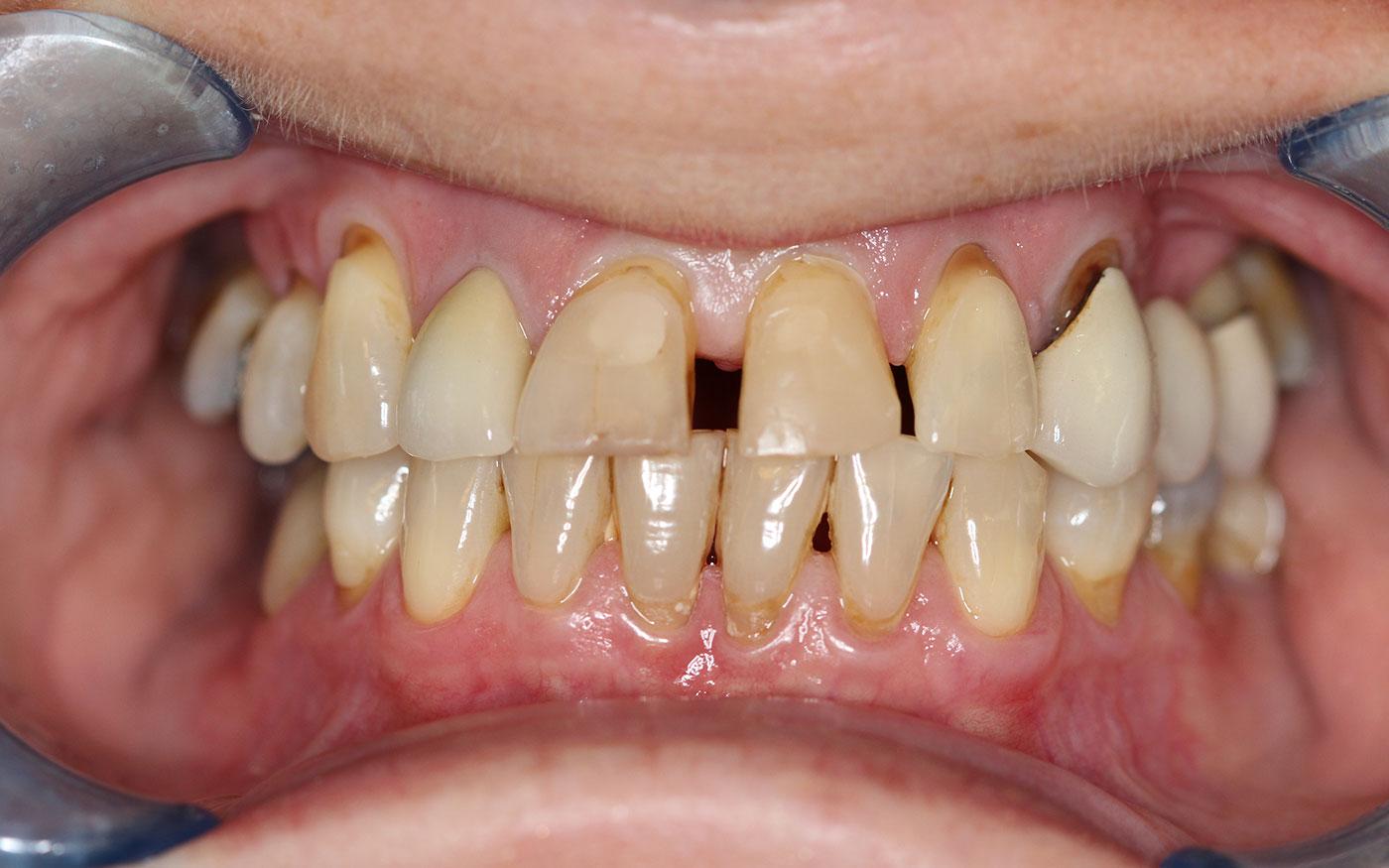 family dentists gallery teeth 3