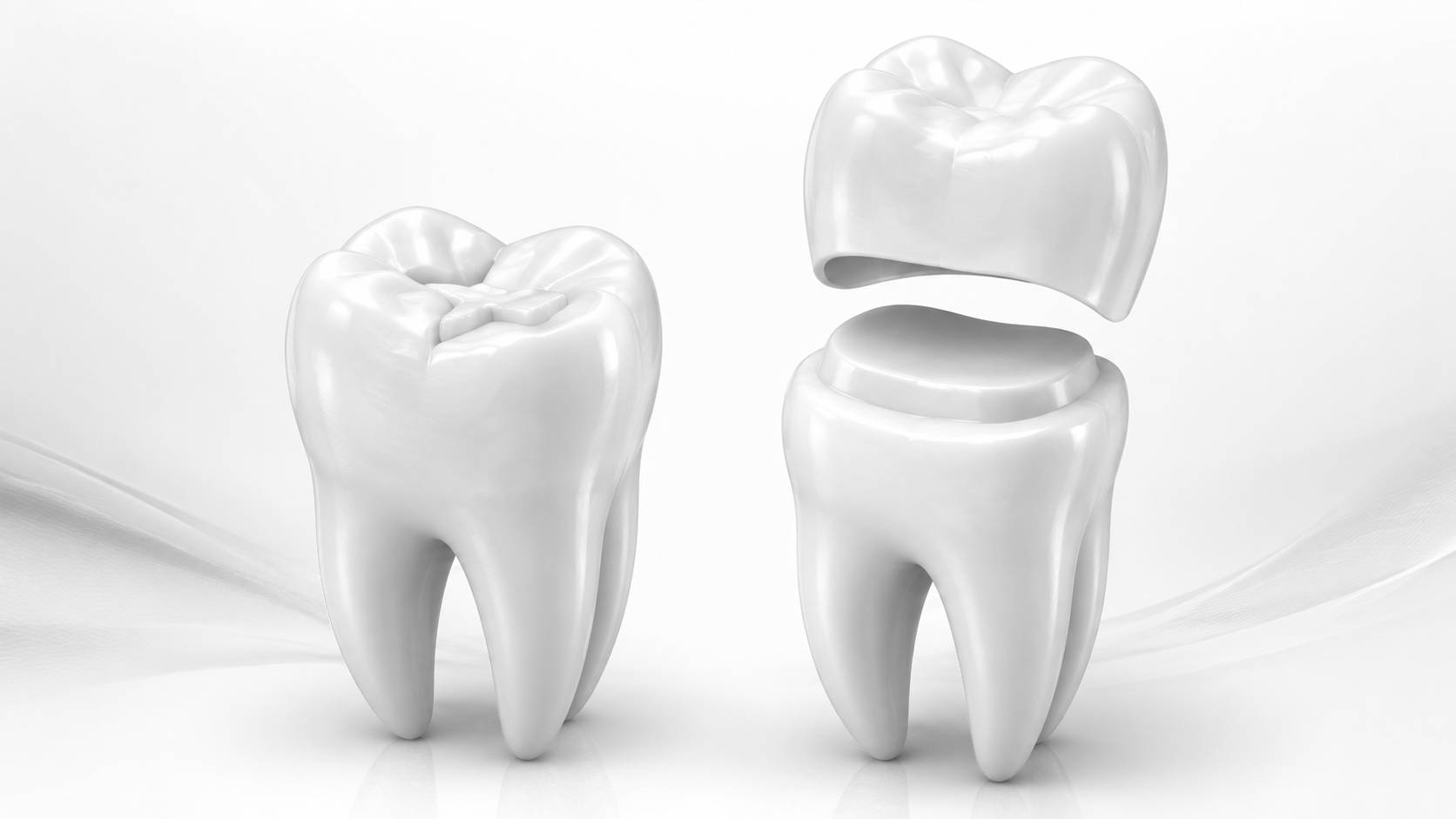 When Does a Tooth Need a Crown Instead of a Filling?